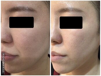 エスビーエス トウキョウ 錦糸町店(SBS TOKYO)/◆ビフォーアフター写真◆