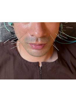 メンズフェイシャル