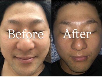 サロンベル(Salon Belle)の写真/NEWOPENサロンで小顔ケアからお肌の手入れまで!第一印象UPを目指すメンズフェイシャル★