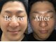 サロンベル(Salon Belle)の写真/NEWOPENサロンで小顔ケアからお肌の手入れまで!第一印象UPを目指すメンズフェイシャル★