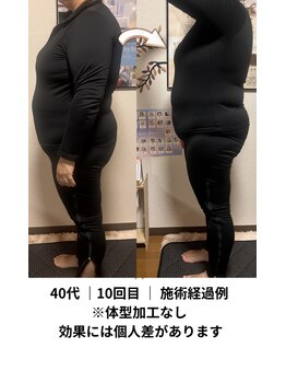 ヨサパーク リノ(YOSA PARK Lino)の写真/本気でサイズダウンを目指す方に☆変わらなかったボディラインを徹底ケア◎ 理想の美ボディをサポート♪