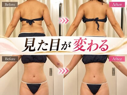 ソエルテ(soerute)の写真
