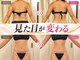 ソエルテ(soerute)の写真