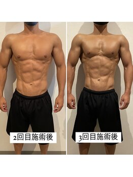 東京デトックス/【BA】インディバボディメイク60