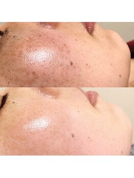 シェリール(Cherir)/ハーブトリートメント