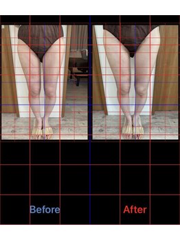 サロンシファ(salon sifa)/インディバ/術後ケア