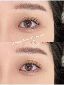 アミーラ(Amira)/フラットラッシュ