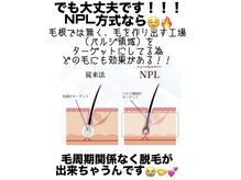 アイビークイーン(I.B.QUEEN)/本格脱毛NPLとは