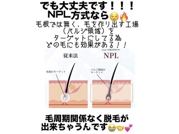 アイビークイーン(I.B.QUEEN)/本格脱毛NPLとは