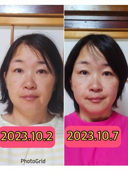 ノウ(nou)/小顔矯正/ヘッドスパ