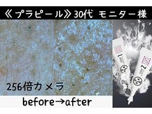 サロンスペース/水光肌【プラピール】モニター様