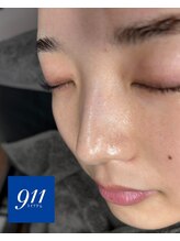 水素ジム911 心斎橋/韓国肌管理*ララピール¥4,800
