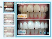 グロウ グロウ(grow.glow)/