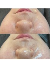 ビーマジック(Be Magic)/フェイシャルWax