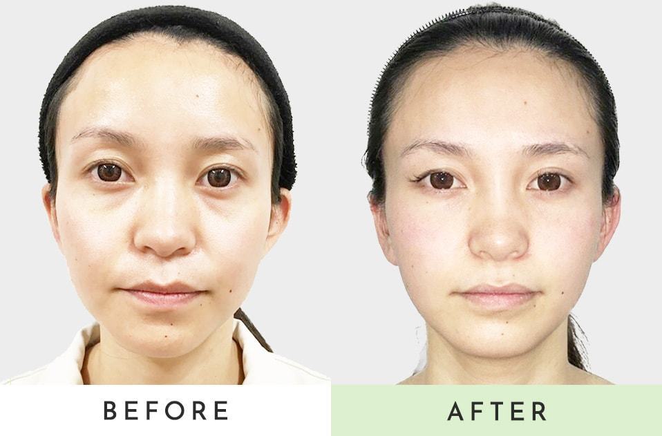 小顔矯正と姿勢矯正と骨盤矯正が評判の女性専用整体院 中百舌鳥駅前店