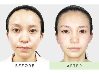 小顔矯正と姿勢矯正と骨盤矯正が評判の女性専用整体院 中百舌鳥駅前店の写真