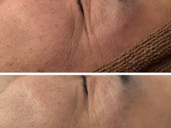 イディアル(IDE'AL)/ハーブ＋CYリキッド＊