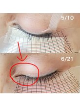 スプーンプラス アイラッシュ(spoon+eyelash)/ラッシュアディクトサロンケア