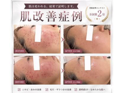 ミベル フェイシャルサロン(MIBELL FACIAL SALON)の写真