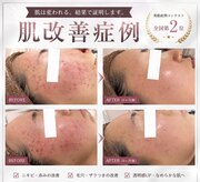 ミベル フェイシャルサロン(MIBELL FACIAL SALON)