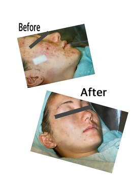 エスティ 京都店/☆