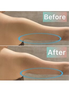 レセラ 銀座店(LE;SERA)/強力痩身マシン