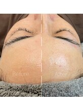 アネラアイラッシュ(Anela eyelash)/