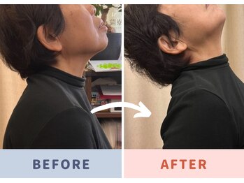 くすの木 治療院/肩こりスッキリ