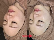 ナチュラックスビューティー 恵比寿店(NaturaxBeauty)/ララピールで速攻ツヤ肌