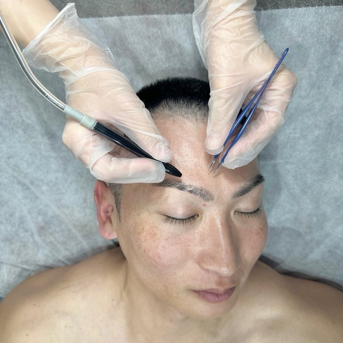 【VIOなし】　美容電気脱毛 15分 　7700円　