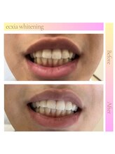 エクシアホワイト SOKA(ecxia white)/