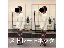 カワル整体 長嶺院/ストレートネック