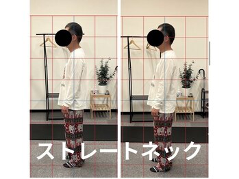 カワル整体 長嶺院/ストレートネック