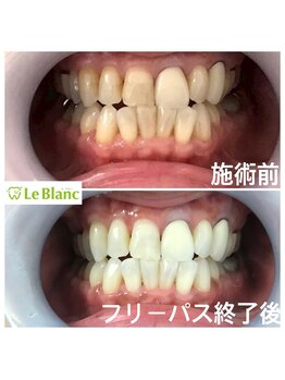 ルブラン 奈良店(Le Blanc)/2周目フリーパス!