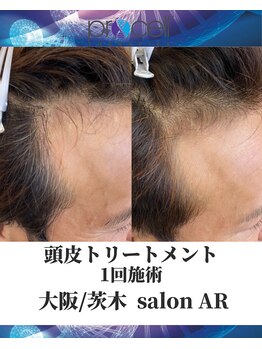 メンズサロンアール(AR)/プロセルセラピーズ