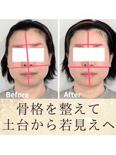 スウ(suu.)/Before-After【40代】1回