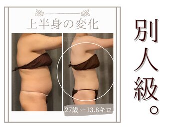 ボディエステティック アクアオーラ 富山店の写真/頑固な脂肪にキャビ！大量発汗で腹肉スッキリ♪くびれを目指し、後ろ姿まで美しく！効果◎◎！