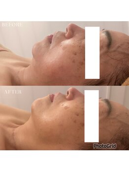 ヴィヴィアン 太田川店(Vivian)/最短で小顔を目指すなら！