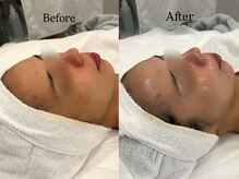 リフコウベ(LIF KOBE)/くすみが気になる方はコレ☆彡