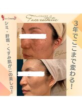 ル クラージュ(Le..Courage)/４２歳美肌へ改善プログラム◎