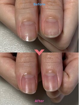 ワイ(Y)/ネイルオフ