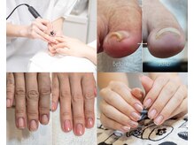 フィフィ ヴィダル(Fifi&Vidal)の雰囲気（【自爪育成×足裏角質】根本から整える専門ケアで健康的な手足へ）