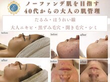 エマーチェ 自由が丘(emmace)の雰囲気(幹細胞美容で大人の肌育。40代からの肌管理。)