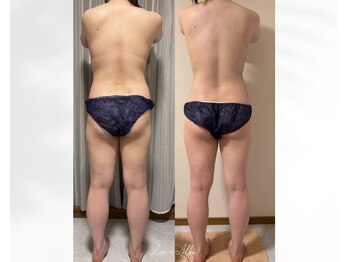 ルーチェアルバ(Luce Alba)の写真/理想のボディラインのシルエットを綺麗に！ダイエットで自信あふれる私へ☆整える技術◎