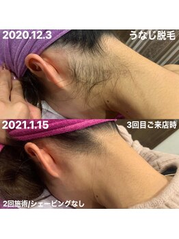 アンリミット(Unlimit)/安心の都度払いもございます♪