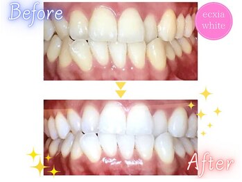 エクシアホワイトニング 京都四条店