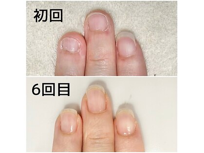 キット(KIT)の写真