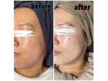 アースコアフュールボーテ 小山店(EARTH coiffure beaute)