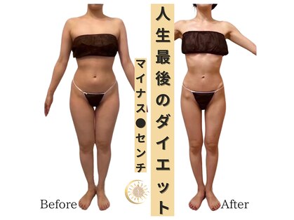 リノア(Lino'aka)の写真