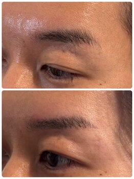 スリーピース(3Peace)/Before/After